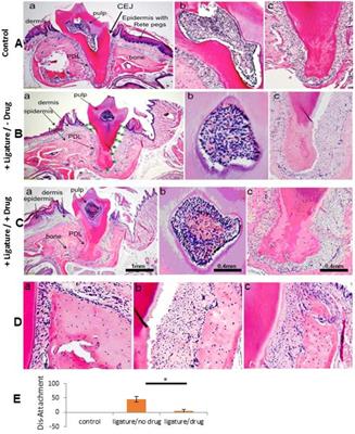 Prolyl-hydroxylase inhibitor-induced regeneration of alveolar bone and soft tissue in a mouse model of periodontitis through metabolic reprogramming